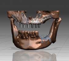 ������ ������ ������ ��������, 60 ���, ������, �������-����������� ����������� �������